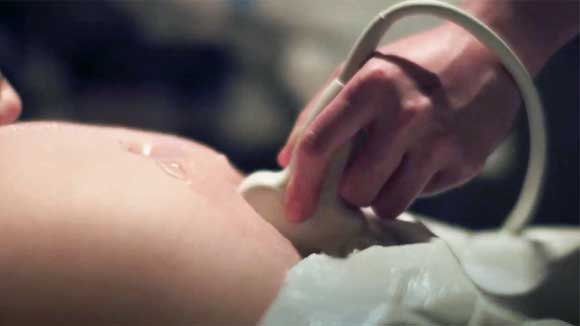 Closeup view of an obgyn resident performing an ultrasound of a pregnant woman's abdomen.